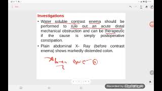 Ogilvie’s syndrome [upl. by Earl]