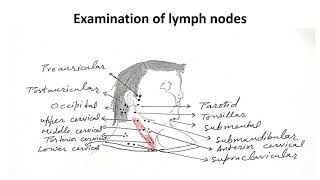 Approach to lymphadenopathy in children  Pediatrics [upl. by Aicella]