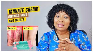 MOVATE SKIN LIGHTENING CREAM amp Skin Bleaching  BENEFITSUSESSIDE EFFECTS [upl. by Yalc415]