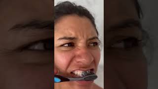 Hoy fui al dentista 🦷 para que me peguen el diente  La CAÑA [upl. by Ytinav]