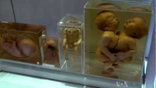 Medical Museum  anatomical collections of bones  preserved human organs [upl. by Levitan]