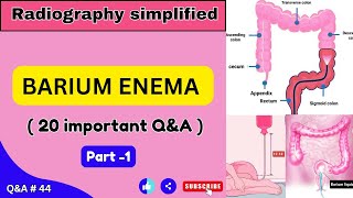 Barium Enema ll 20 important QampA ll Viva QampA 44 ll Radiography Simplified ll [upl. by Dorsey]