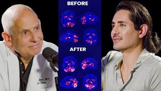 Meditation Changed My Brain  Scan Proves it  AmenClinic sadhguru FrankElaridi [upl. by Albur684]