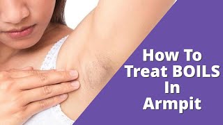 Home Treatment For Boils In Armpit That Works  Inflamed Cysts [upl. by Sylera]