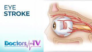 EYE STROKE Central Retinal Artery Occlusion  Doctors on TV [upl. by Anaigroeg]