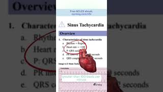 💓 Sinus Tachycardia [upl. by Oguh926]