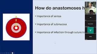 Anastomotic leak group discussion lakshman 231005 [upl. by Cyprus]