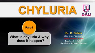 CHYLURIA  What is chyluria amp why does it happen [upl. by Heddy]