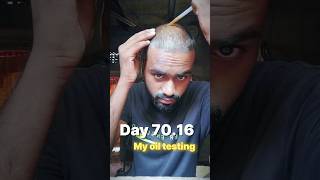 Day 7016 my oil testing for hair regrowth hairregrowth [upl. by Welcome]