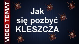 Jak usunąć kleszcza  Skuteczne sposoby na kleszcze [upl. by Lodi]