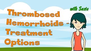 Thrombosed Hemorrhoids  Treatment Options to Stop the Pain [upl. by Nehepts909]