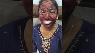 Beetroot powder face mask review purpleproducts review skincare facepack beetrootpowder [upl. by Meneau]