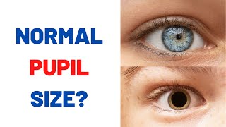 Are your pupils normal size [upl. by Portie]