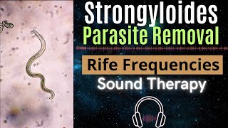 Rife Frequencies for Strongyloides Parasite Removal [upl. by Adnalay]