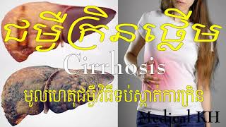 Cirrhosisជម្ងឺក្រិនថ្លើមវិធីទប់ស្កាត់ការក្រិនថ្លើមនាទីសុខភាពខ្ញុំ Dr Om Sereyvichit [upl. by Aticilef]