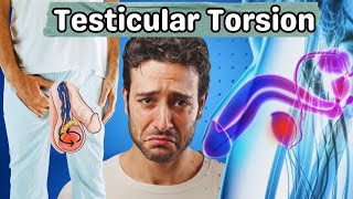 Testicular Torsion  What Happens in Testicular Torsion  Symptoms Causes And Treatment UrduHindi [upl. by Pratte865]