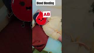 Why Medical Students Need Blood Bank Experience [upl. by Janeva463]