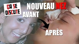 Chirurgie esthétique  elle pleure en voyant son nouveau nez   Ça se discute [upl. by Nagel]