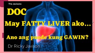 HOW TO Treat your FATTY LIVER Gawin mo ito Usapang Atay with Dr Ricky Javison [upl. by Sculley246]