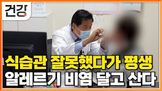 건강했던 몸에 갑자기 찾아온 알레르기 비염│무너진 면역 때문에 기관지로 파고든 병│비염 원인이 된 최악의 식습관│명의│EBS건강 [upl. by Hilten]