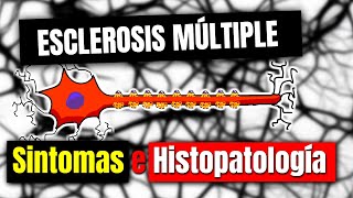 Esclerosis múltiple SINTOMAS E HISTOPATOLOGÍA  P2 [upl. by Savanna817]