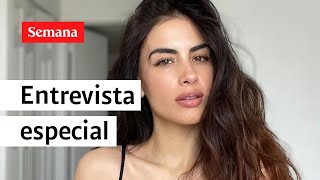 Jessica Cediel en SEMANA emocional entrevista sobre su caso de biopolímeros  Semana Noticias [upl. by Ducan93]