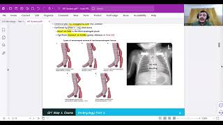 Pathologic GIT Embryology Part 1 [upl. by Aikal]