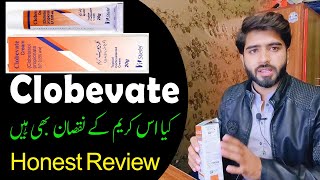 Clobevate Cream For Whitening  Clobevate Uses In Urdu  Clobevate  Babar Ali [upl. by Otreblada]