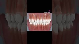 Deciduous vs permanent tooth dentistry dentalprocedure dentaltreatment [upl. by Nonnaihr686]