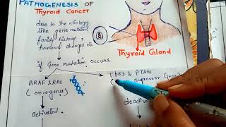 pathogenesis of thyroid cancer NGMedicals [upl. by Haldis]