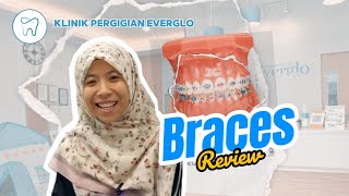 Everglo  Braces Review [upl. by Cut]