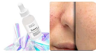 The Ordinary Niacinamide10Zinc1  Acne Open Pores  Wrinkles Use Ordinary Serum By Rukhma Naveed [upl. by Akered]