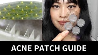 Guide to Acne Patches Hydrocolloid Treatment Microneedle  Lab Muffin Beauty Science [upl. by Karlee]