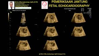 FETAL ECHOCARDIOGRAPHY [upl. by Nerine]