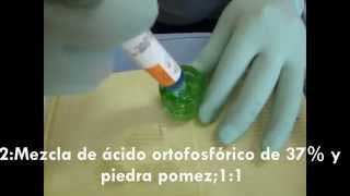 TECNICA DE MICROABRASION  UNMSM [upl. by Norven]