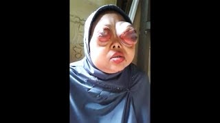 this womans eyes literally exploded [upl. by Tudor]