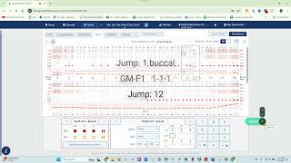 Voice Enabled Perio Charting amp PHI Reporting for Dentrix Ascend with Denti AI Voice [upl. by Atoel]