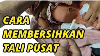 BABY UMBILICAL CORD CARE  CARA MEMBERSIHKAN TALI PUSAT BAYI YANG BENAR [upl. by Arawaj13]