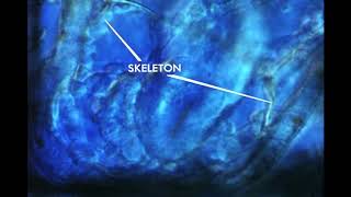 21 Echinoderm Development Gastrulation [upl. by Cristal115]