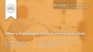 When a blacklegged tick bite is more than a bite [upl. by Colpin]