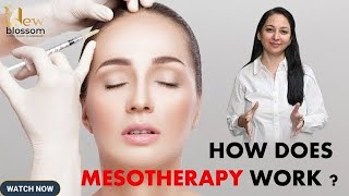 Mesotherapy for skin  How mesotherapy work [upl. by Llig]