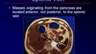 Sonography of the Pancreas and Spleen [upl. by Anirdua745]