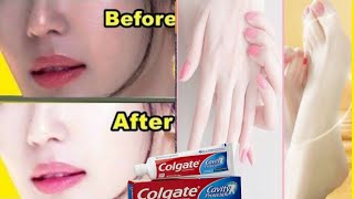 COLGATE TOOTHPASTE FOR FACE WHITENING  LEMON AND COLGATE [upl. by Orling525]