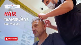 StepbyStep Hair Transplant Procedure  What to Expectquot [upl. by Nadler]