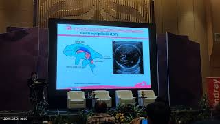 Screening fetal brain anatomy Qingqing wu [upl. by Anasxor]