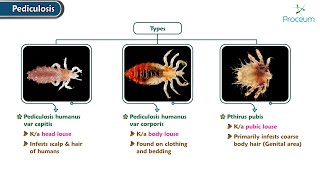 Pediculosis  Dermatology Lectures [upl. by Suedaht259]