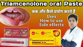 Kenacort 01  Kenacort gel how to use  Triamcinolone oromucosal paste bp 01 ww [upl. by Reg]