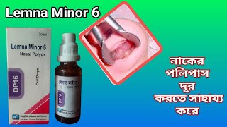 Lemna Minor 6 \\Nasal Polyps\\Oral Drops\\ নাকের পলিপাস চিকিৎসা ঔষধ সেবন করুন Bangla Review [upl. by Nessi]