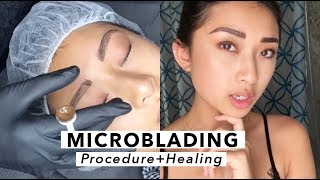 Microblading  Healing Process [upl. by Lecram]