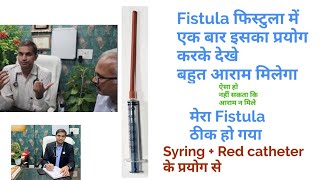 100 Cure Fistula in ano  Treatment of Fistula  ksharsutra Treatment Pilomedcom 8858287131 [upl. by Amersham824]